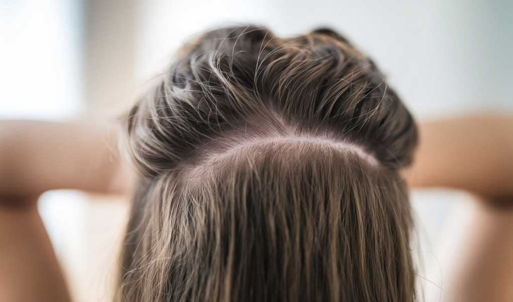 cheveux-epais-cuir-chevelu-sain