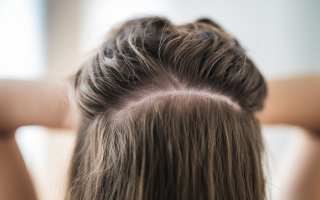 cheveux-epais-cuir-chevelu-sain