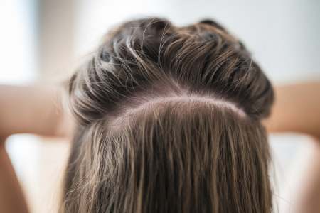 cheveux-epais-cuir-chevelu-sain