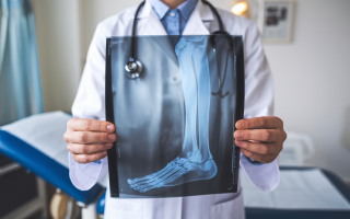 professionnel-sante-blouse-radiographie-jambe