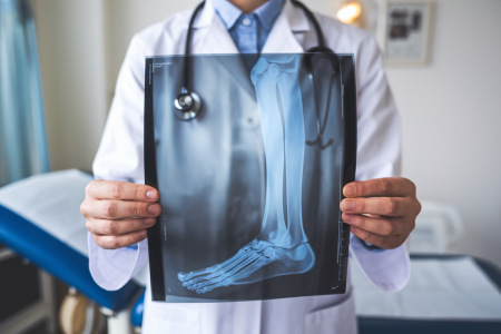 professionnel-sante-blouse-radiographie-jambe