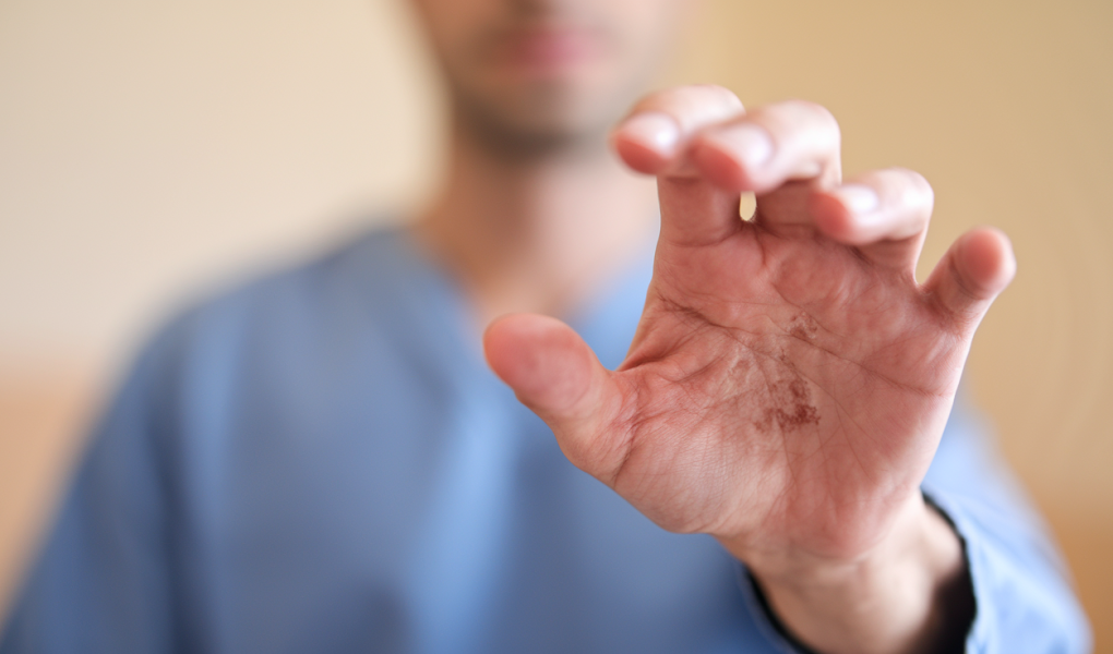 main-adulte-keratose-peau-clarte