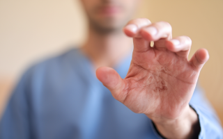 main-adulte-keratose-peau-clarte