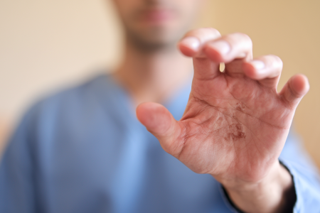 main-adulte-keratose-peau-clarte